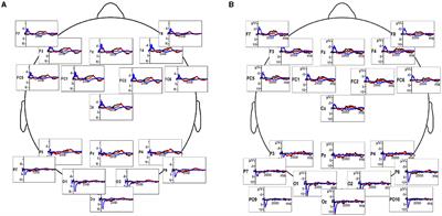 Prediction underlying comprehension of human motion: an analysis of Deaf signer and non-signer EEG in response to visual stimuli